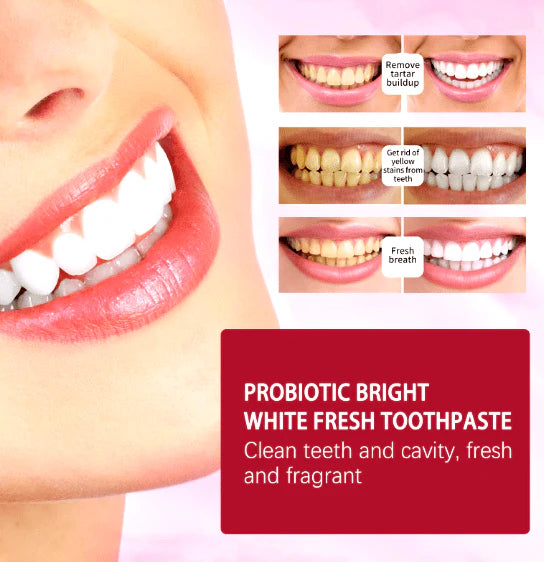 Sp-4 Toothpaste-FREE SHIPPING